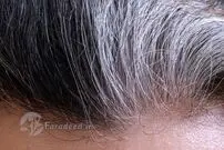 مو‌های خاکستری رنگ در مورد سلامتی چه می‌گویند
