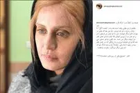 عکس/ گریم متفاوت الناز شاکردوست