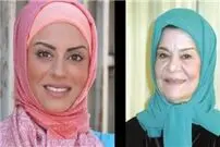 چون جراحی زیبایی نکرده به او کار نمی‌دهند!
