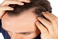 برای تقویت مو‌های آسیب دیده چه کنیم؟