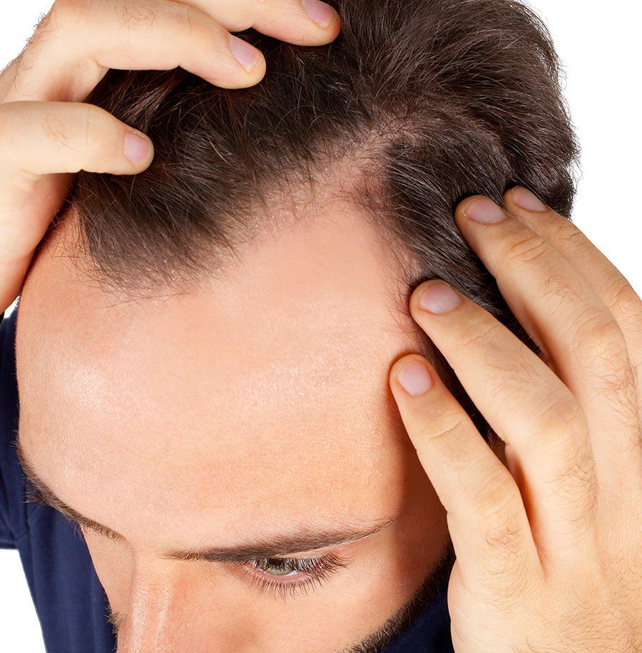 برای تقویت مو‌های آسیب دیده چه کنیم؟