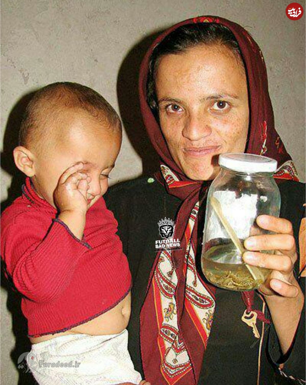 ماجرای مرموز عقربهای بدن کودک دهدشتی