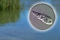 کشف میکروب "مغزخوار"، در آب آشامیدنی