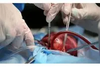 تصویری شگفت انگیز از قلب زنده قبل از عمل پیوند