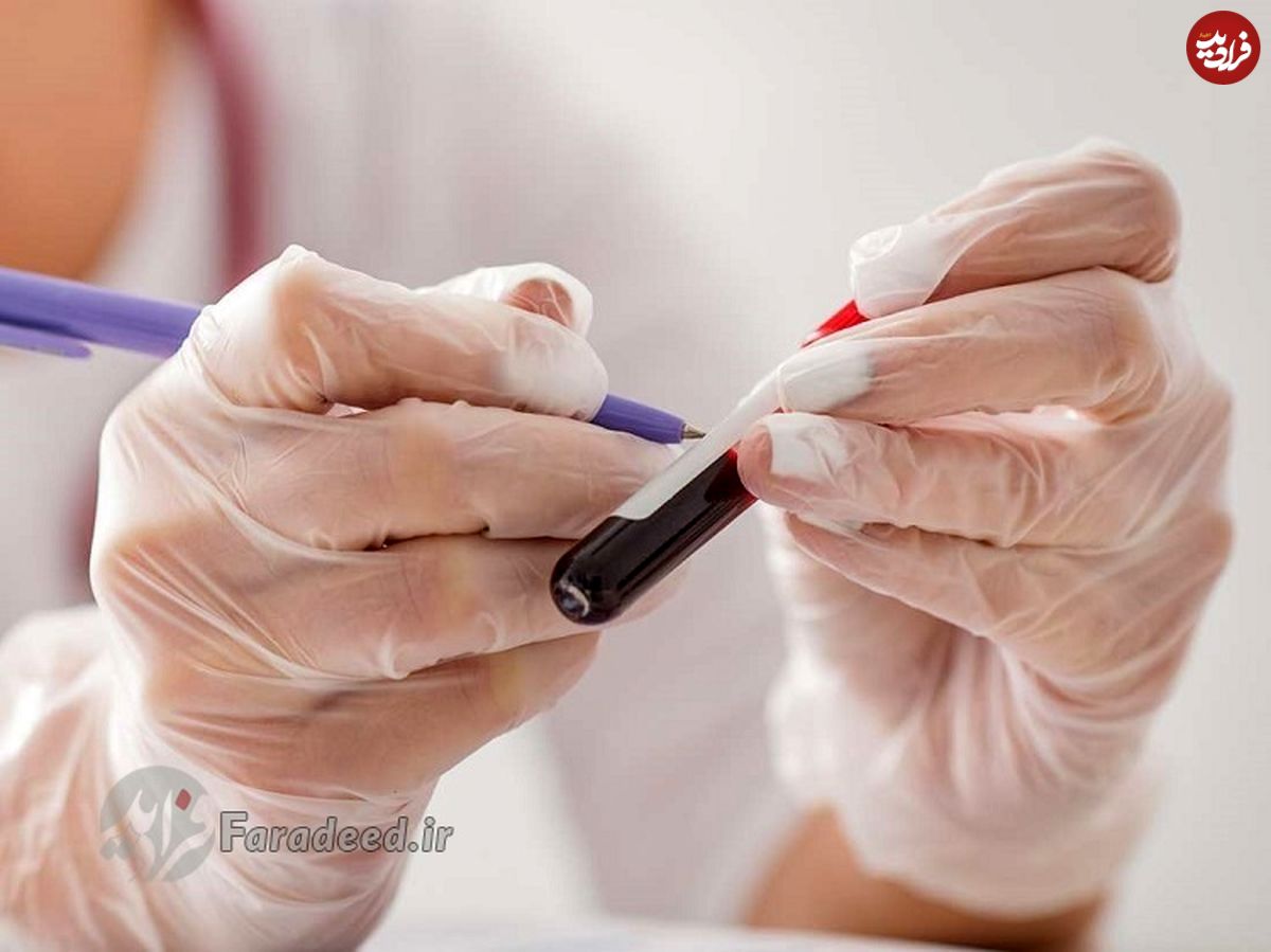 MCHC در آزمایش خون، از دلایل پایین بودن تا تشخیص و درمان