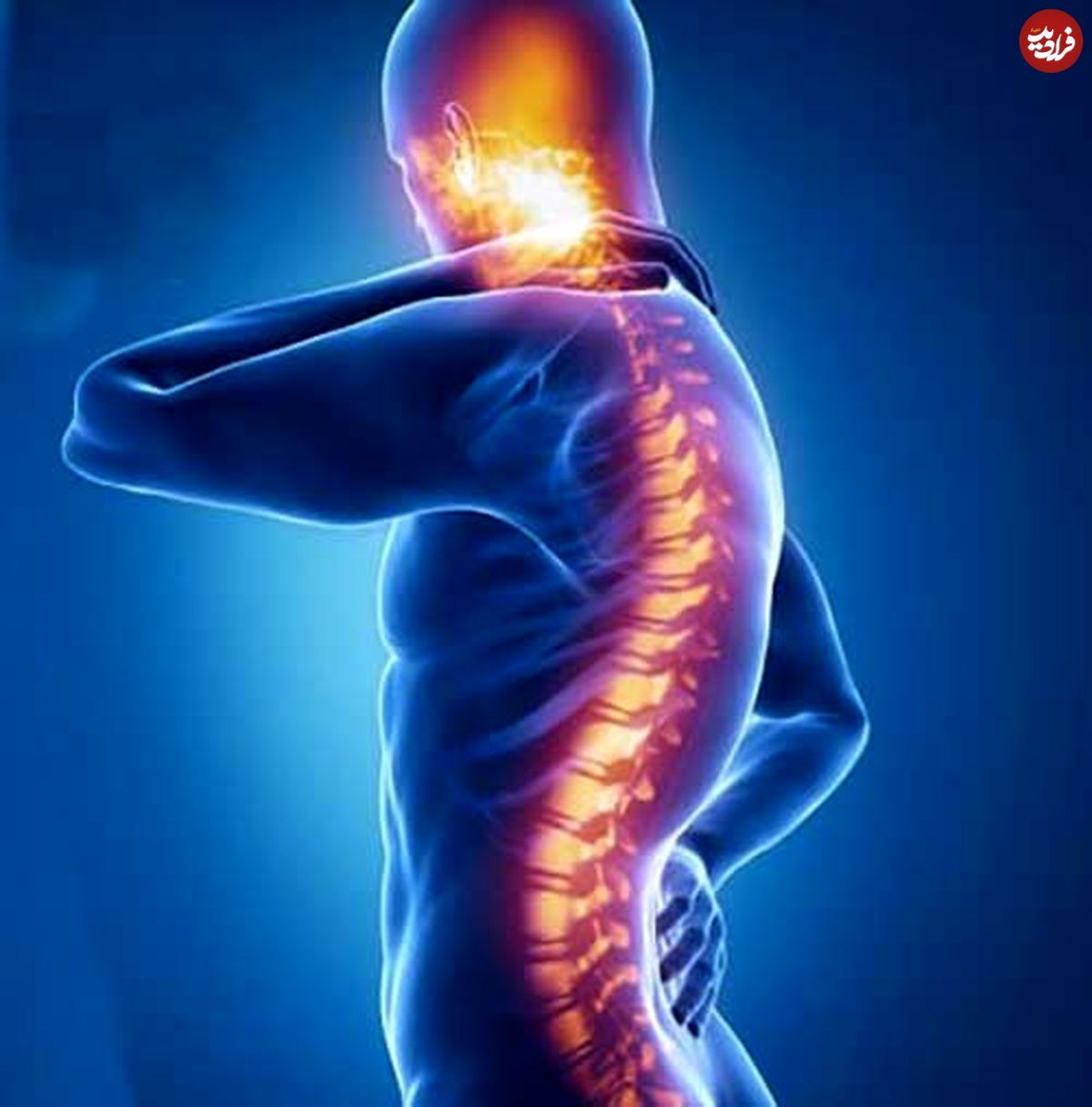چند حرکت اصلاحی برای رفع گودی کمر