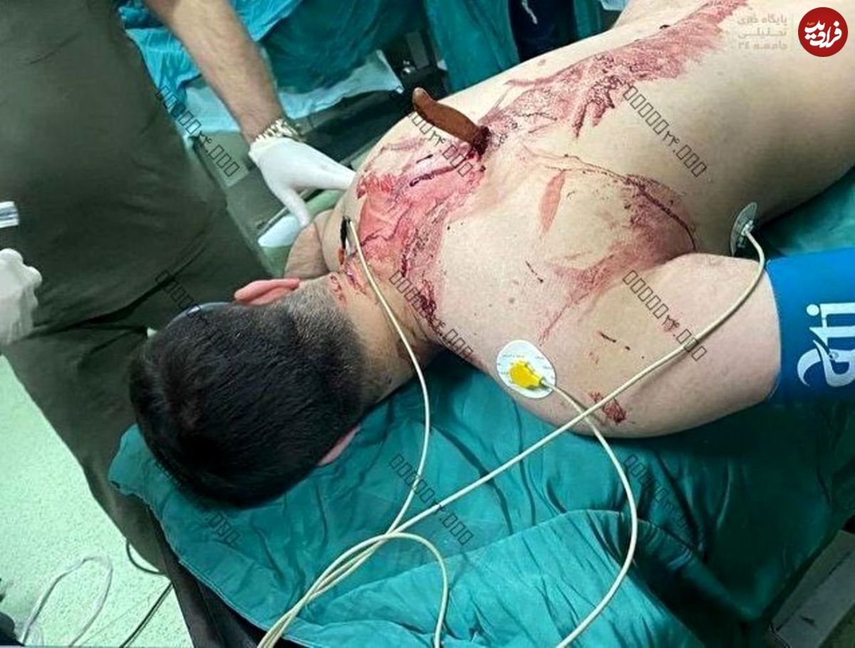 عکس + ۱۸/ حمله با چاقو به پرستارِ بیمارستان شهدای تجریش