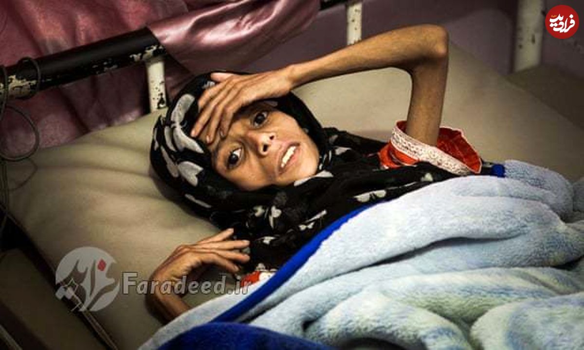نسل آینده یمنی‌ها در حال ناپدید شدن است