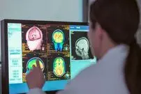 ساختار مغز بعد از درمان افسردگی دوباره احیاء می‌شود!