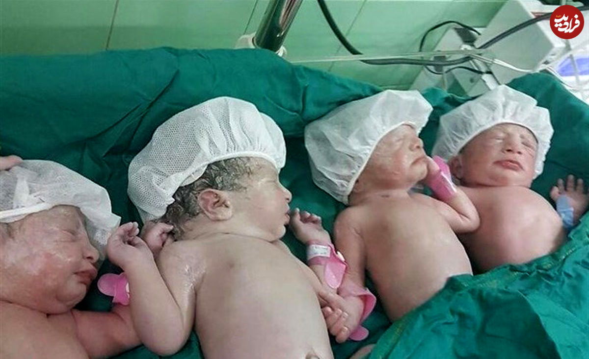 تولد چهارقلوهای مشهدی