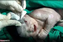 مادربزرگی که با تیغ نوه‌اش را به دنیا آورد