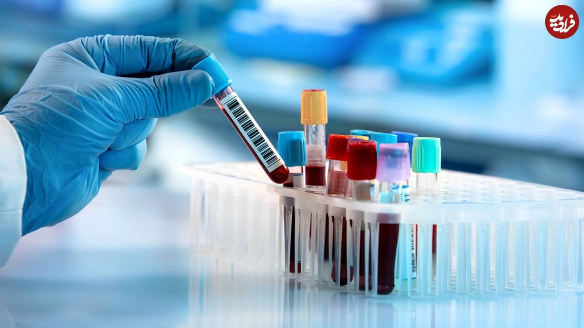 تشخیص پنجاه نوع سرطان با آزمایش جدید خون