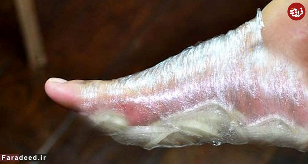 با پیاز به استقبال سرما بروید