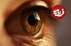 تشخیص پوکی استخوان با نگاه به چشم!