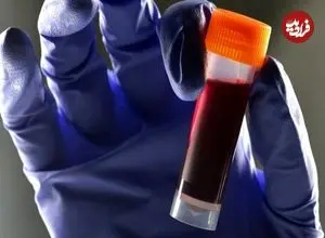 دارندگان این گروه خونی بیشتر مراقب دیابت باشند!