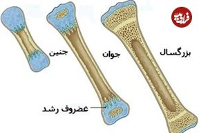 اینفوگرافی؛ عمر کوتاه استخوان‌های ایرانی