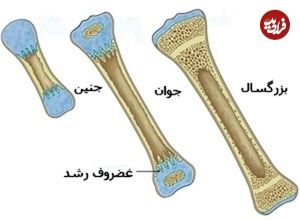 اینفوگرافی؛ عمر کوتاه استخوان‌های ایرانی