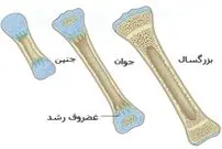 اینفوگرافی؛ عمر کوتاه استخوان‌های ایرانی