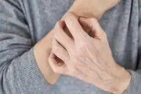 خطاهای رایج پوستی در هوای سرد