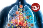 این 20 بیماری چه زمانی خطرناک می شوند؟