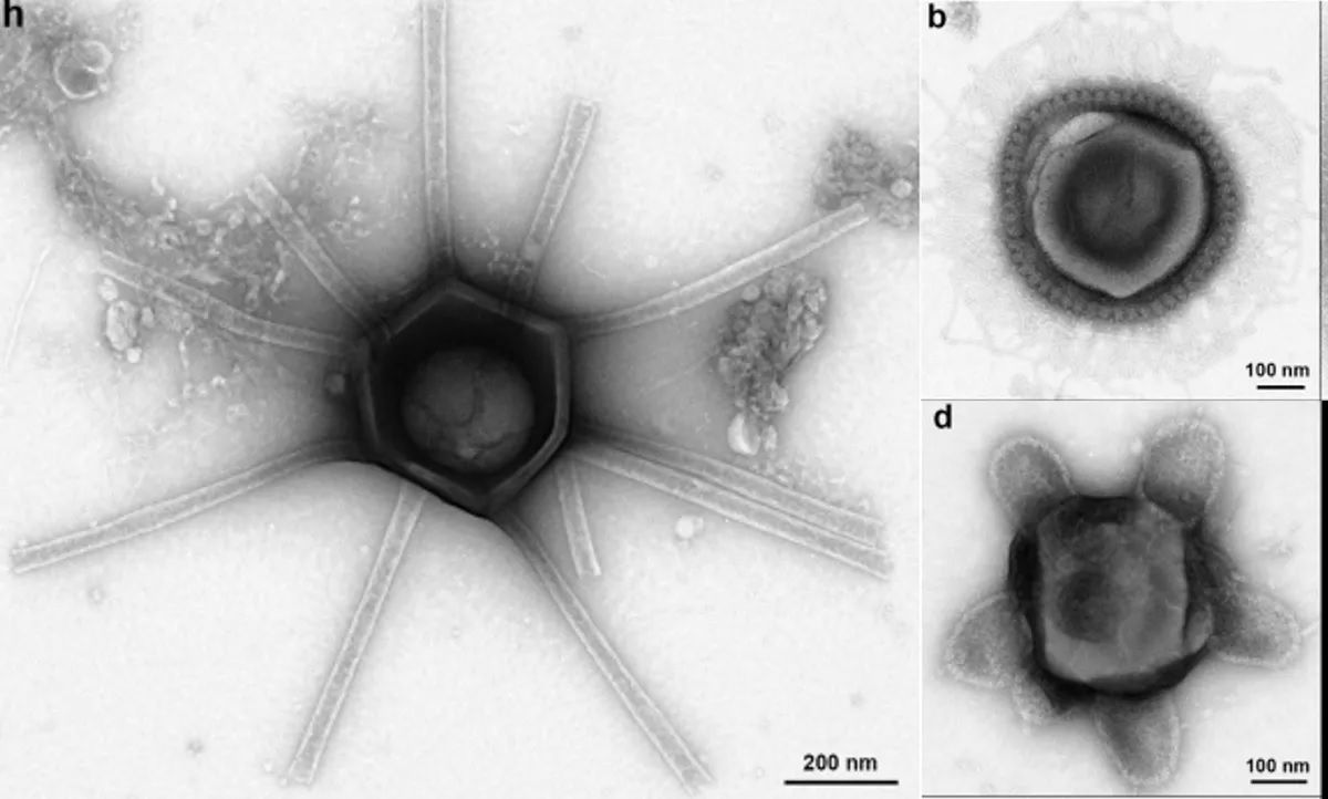 کشف ویروس‌هایی با شکل‌های عجیب در خاک جنگل؛ از «زن بدسیما» تا «لوله‌کش»!