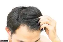 روش هایی برای رشد مو