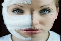 هزینه های گزاف جراحی زیبایی
