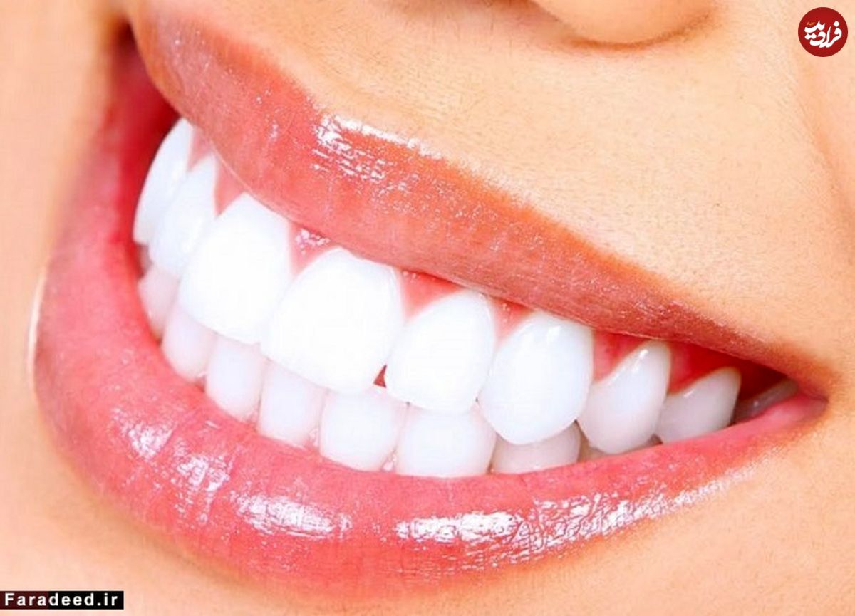 چطور دندانهای سفیدی داشته باشید؟