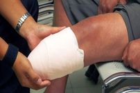 این بیماری خطرناک می‌تواند منجر به قطع عضو شود!