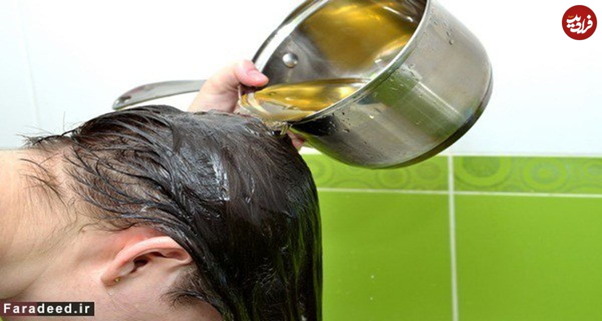 معجزه طبیعی برای جلوگیری از ریزش مو