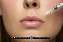 آیا تزریق ژل عوارض جانبی دارد ؟