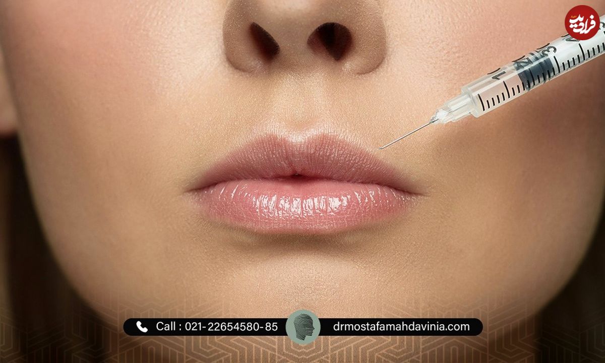 آیا تزریق ژل عوارض جانبی دارد ؟
