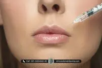 آیا تزریق ژل عوارض جانبی دارد ؟
