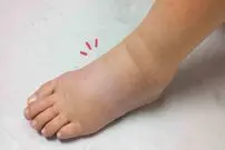 اگر این علائم را دارید به متخصص قلب مراجعه کنید!