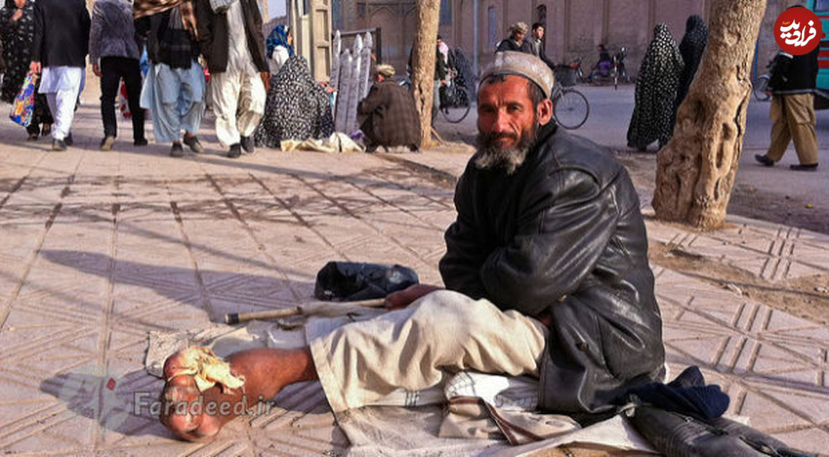 در مورد بیماری لاعلاج "پافیلی" چه می‌دانید؟