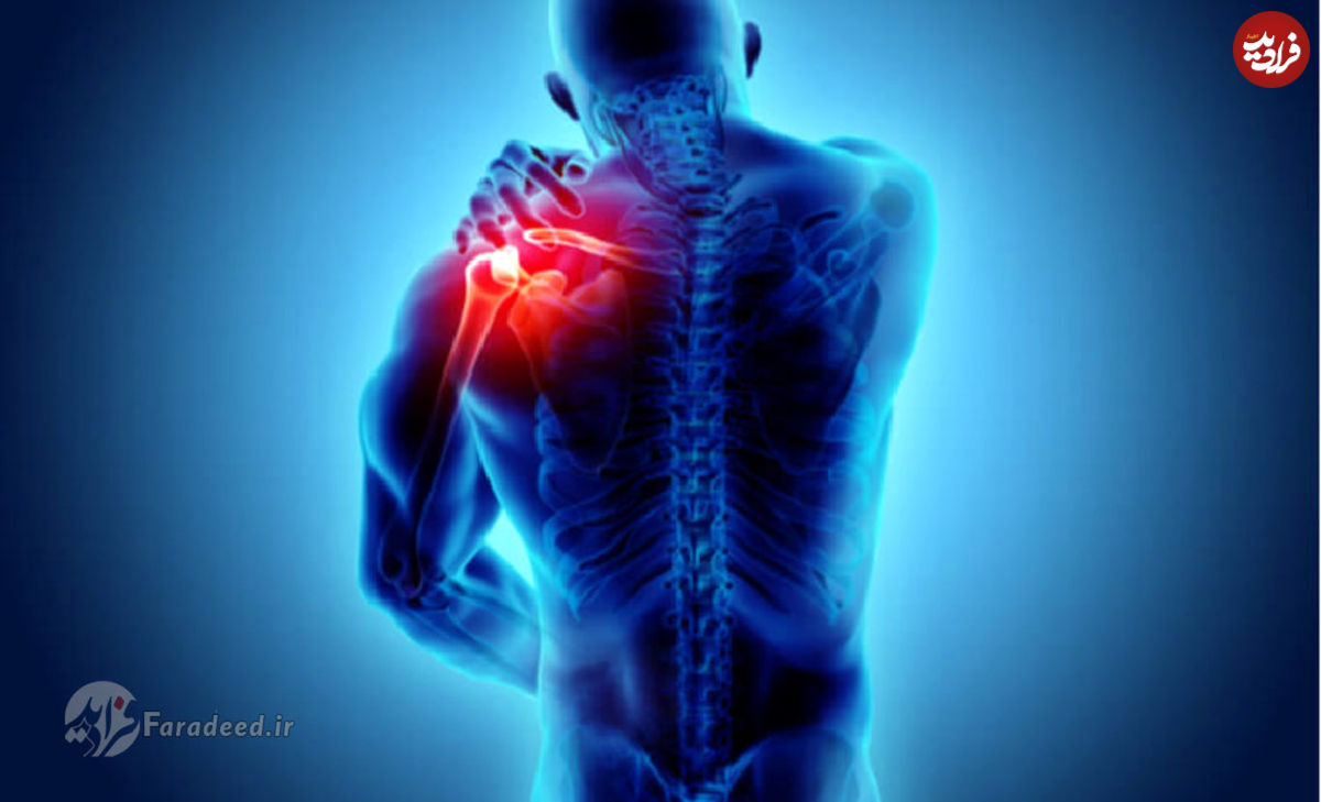 چطور گرفتگی عضلات را درمان کنیم؟