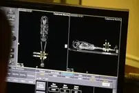 مرد 2 هزار ساله سرطان داشت!
