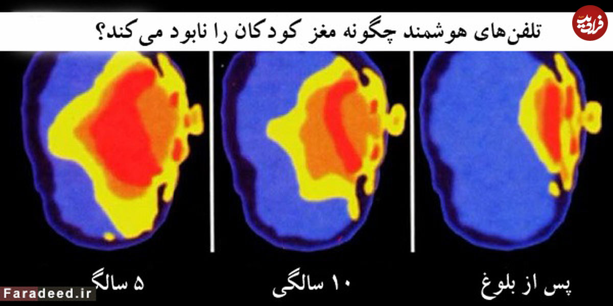 تلفن‌های هوشمند چگونه مغز کودکان را نابود می‌کنند؟