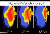 تلفن‌های هوشمند چگونه مغز کودکان را نابود می‌کنند؟