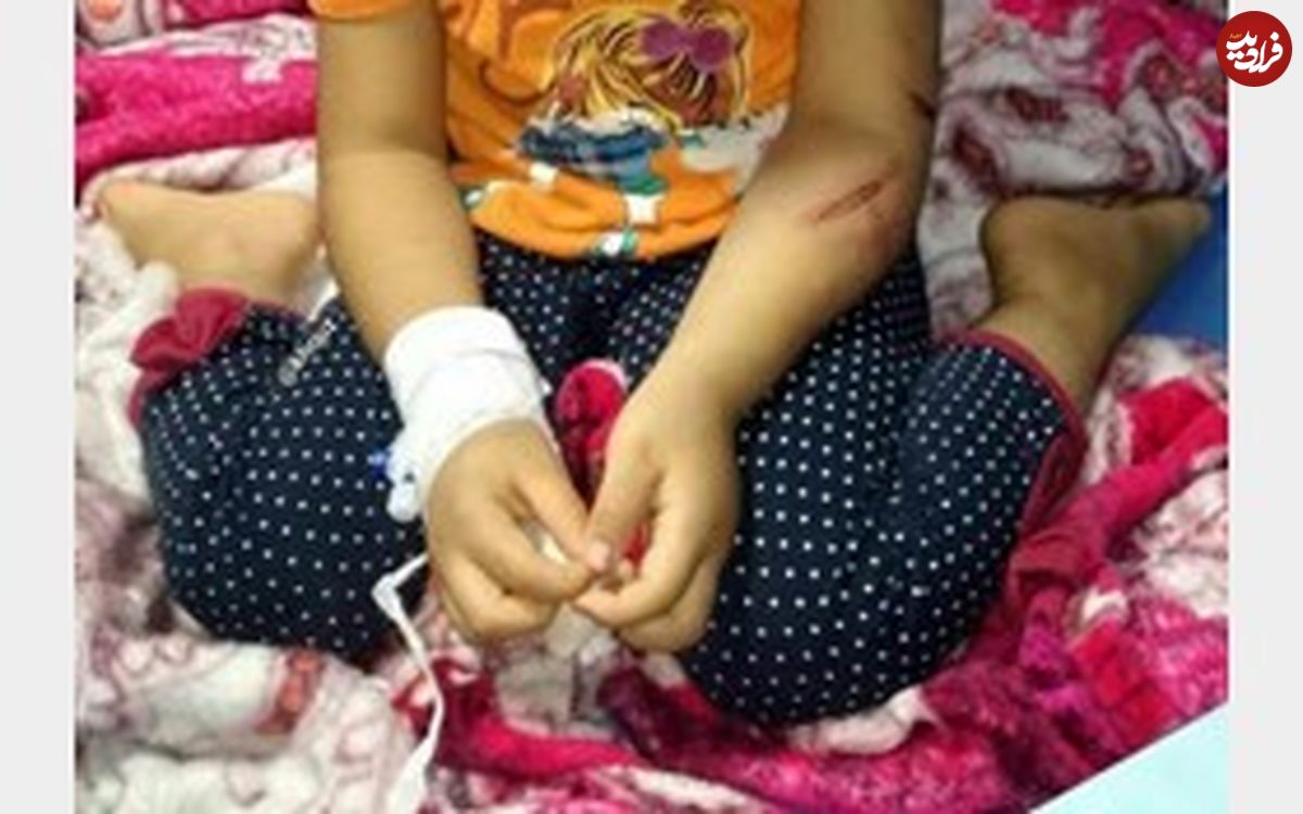 دختر چهار ساله‌ای که اسیر شکنجه عمویش شد