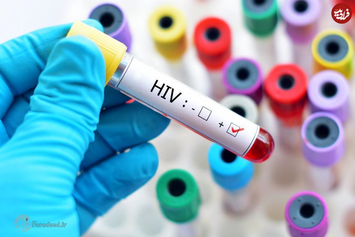 کشف نوع جدیدی از واکسن ایدز