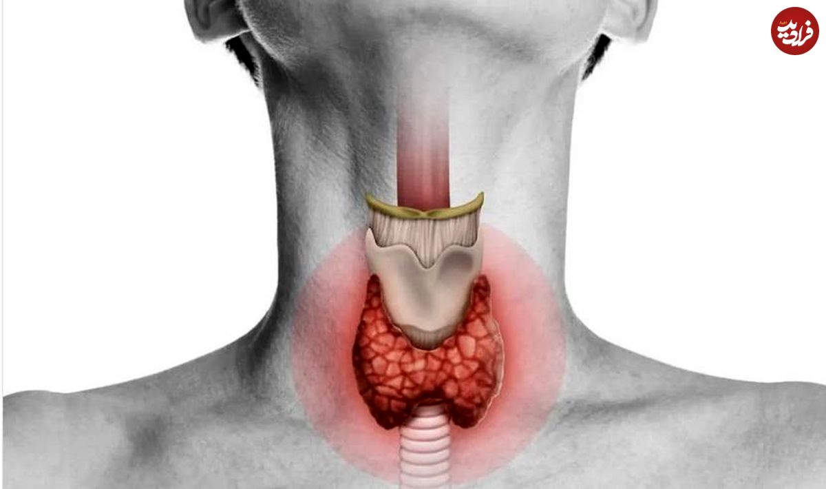 با قاتل کم کاری تیروئید آشنا شوید