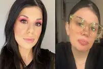این زن اهل استرالیا ۵ اندام اضافی در بدن خود دارد