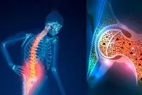 افزایش پوکی استخوان با خوردن این نوشیدنی