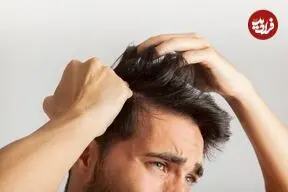 چرا برخی افراد موهای خود را می‌کنند؟