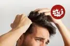 چرا برخی افراد موهای خود را می‌کنند؟