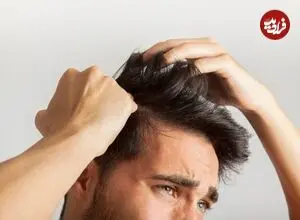 چرا برخی افراد موهای خود را می‌کنند؟