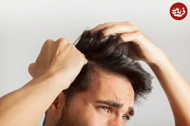 چرا برخی افراد موهای خود را می‌کنند؟