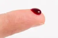 علائم لخته شدن خون را بدانید