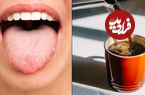 این نشانه روی زبان می‌گوید نباید قهوه بنوشید؛ رنگ‌های مختلف زبان نشانه چیست؟